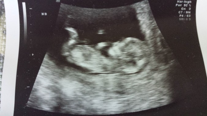 These Walls - 7QT34 - 5