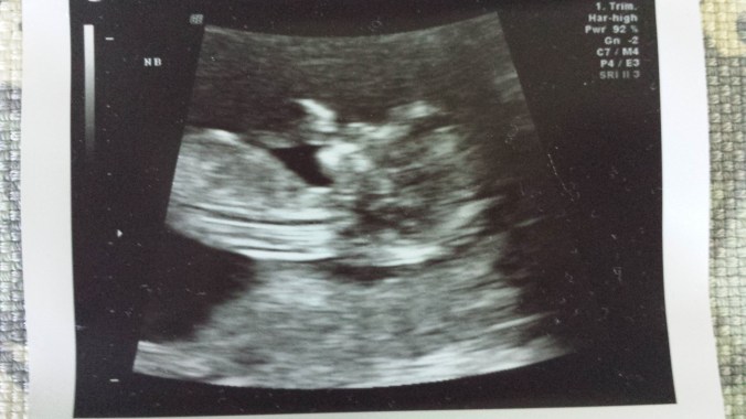 These Walls - 7QT34 - 6