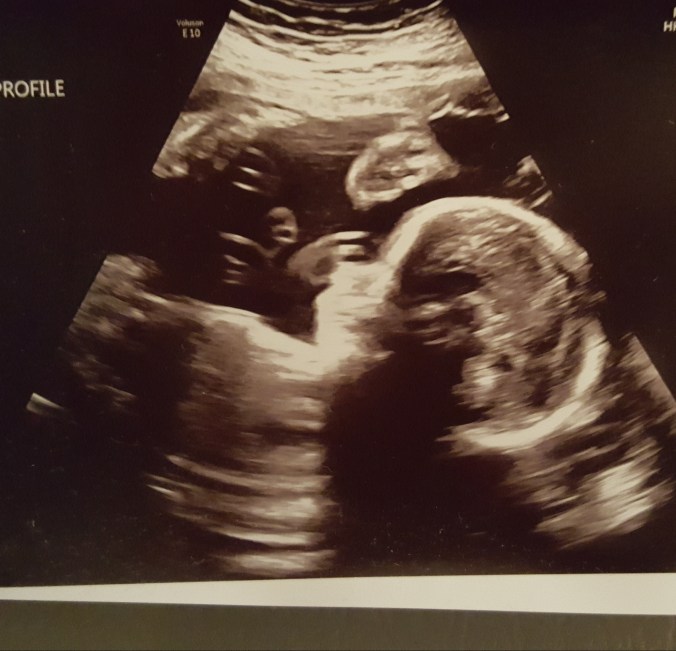 These Walls - 7QT45 - 2